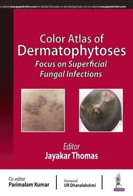 bokomslag Color Atlas of Dermatophytoses