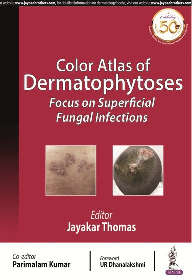 bokomslag Color Atlas of Dermatophytoses