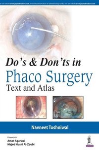bokomslag Do's & Dont's in Phaco Surgery