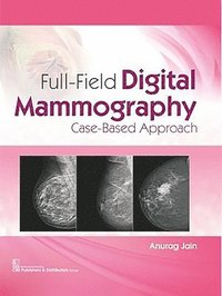 bokomslag Full-Field Digital Mammography