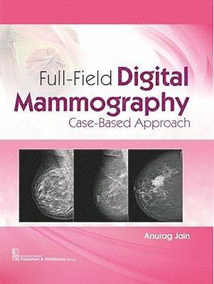 Anurag Jain - Full-Field Digital Mammography, Inbunden