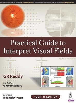 Practical Guide to Interpret Visual Fields 1