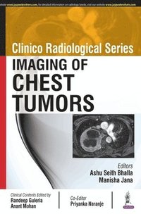 bokomslag Clinico Radiological Series: Imaging of Chest Tumors