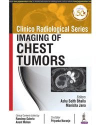 bokomslag Clinico Radiological Series: Imaging of Chest Tumors