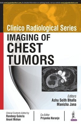 Clinico Radiological Series: Imaging of Chest Tumors 1
