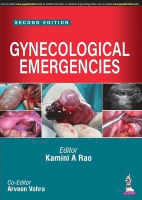 Gynecological Emergencies 1