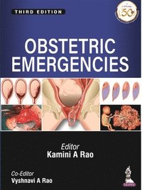 bokomslag Obstetric Emergencies