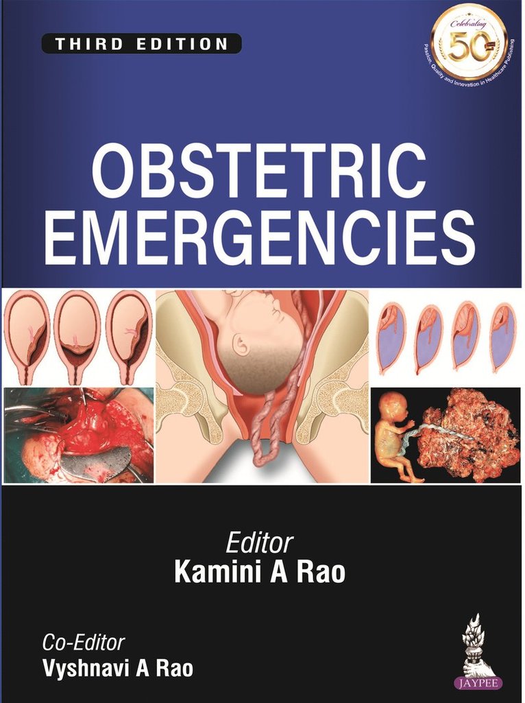 Kamini A Rao, Vyshnavi A Rao - Obstetric Emergencies, Häftad
