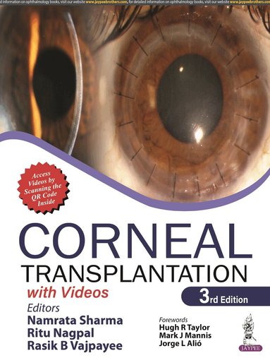 Namrata Sharma, Ritu Nagpal, Rasik B Vajpayee - Corneal Transplantation, Häftad