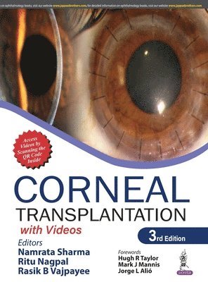 Corneal Transplantation 1