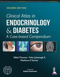 bokomslag Clinical Atlas in Endocrinology and Diabetes