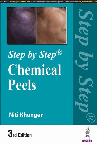 bokomslag Step by Step: Chemical Peels