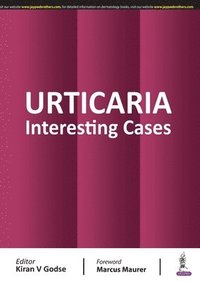 bokomslag Urticaria