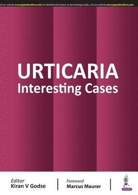 Urticaria 1