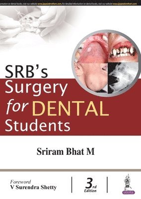 bokomslag SRBs Surgery for Dental Students