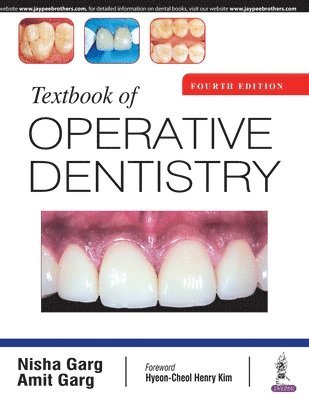 Nisha Garg, Amit Garg - Textbook of Operative Dentistry, Häftad