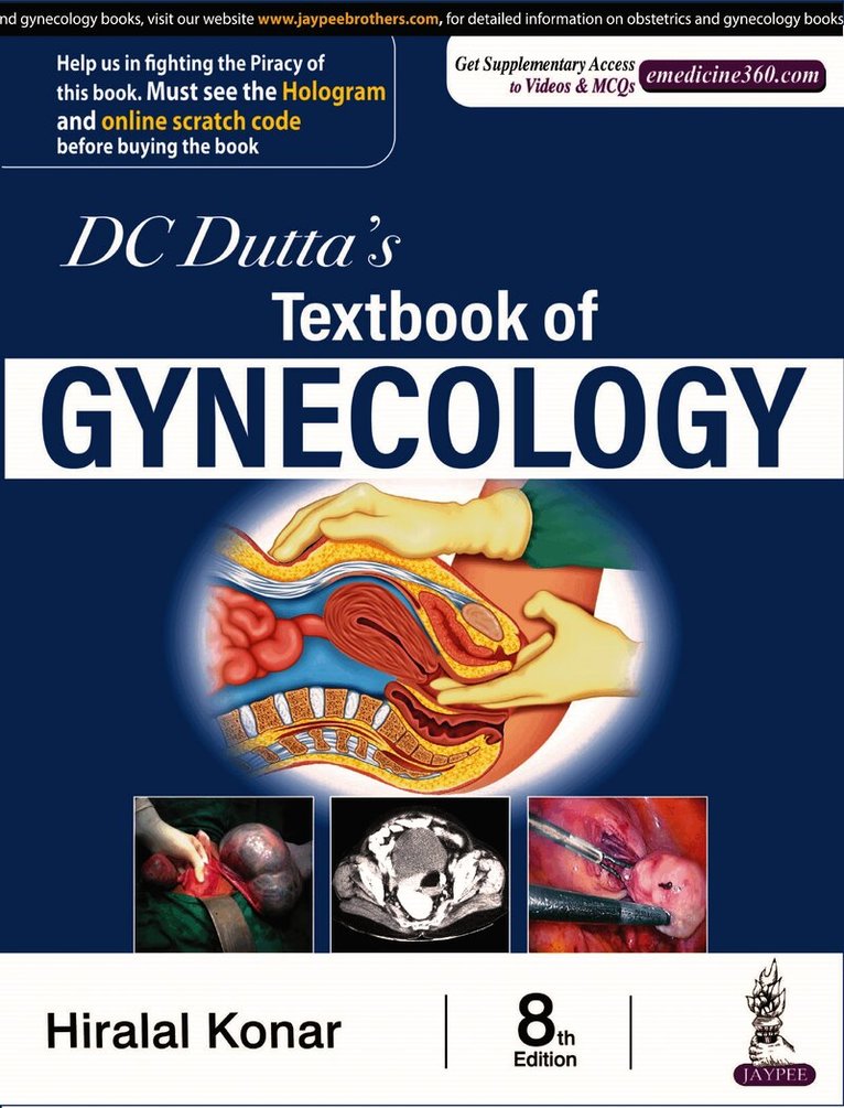 DC Dutta's Textbook of Gynecology