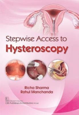 bokomslag Stepwise Access to Hysteroscopy