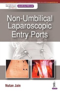 bokomslag Non-Umbilical Laparoscopic Entry Ports