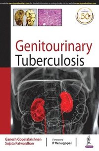 bokomslag Genitourinary Tuberculosis