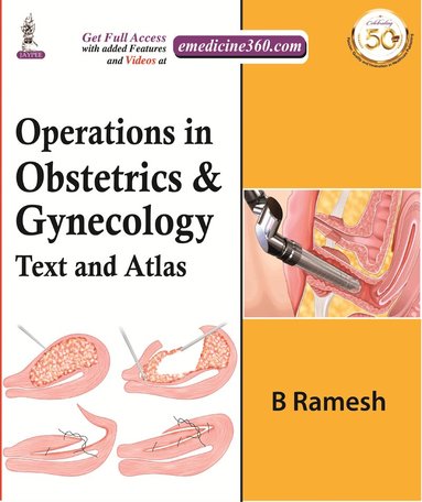 B Ramesh - Operations in Obstetrics & Gynecology, Inbunden