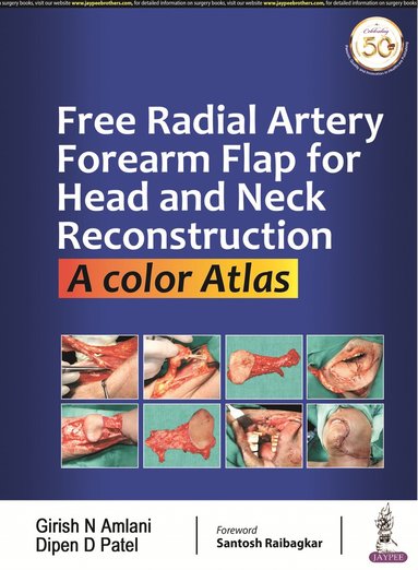 bokomslag Free Radial Artery Forearm Flap for Head and Neck Reconstruction