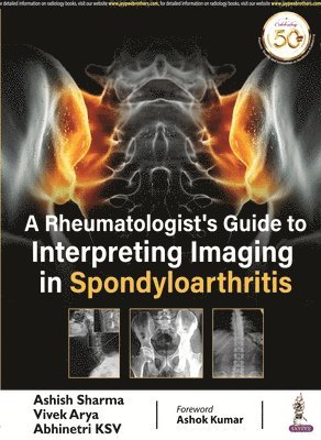 Ashish Sharma, Vivek Arya, Abhinetri KSV - Rheumatologist's Guide to Interpreting Imaging in Spondyloarthritis, Häftad