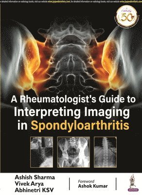 A Rheumatologist's Guide to Interpreting Imaging in Spondyloarthritis 1