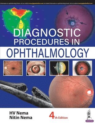 HV Nema, Nitin Nema - Diagnostic Procedures in Ophthalmology, Häftad
