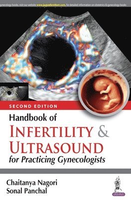 Handbook of Infertility & Ultrasound for Practicing Gynecologists 1
