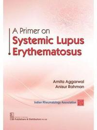 bokomslag A Primer on Systemic Lupus Erythematosus