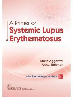 A Primer on Systemic Lupus Erythematosus 1