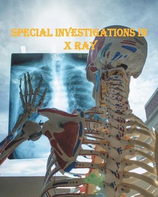 Special Investigations in X Ray 1