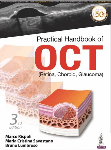 Marco Rispoli, Maria Cristina Savastano, Bruno Lumbroso - Practical Handbook of OCT, Häftad