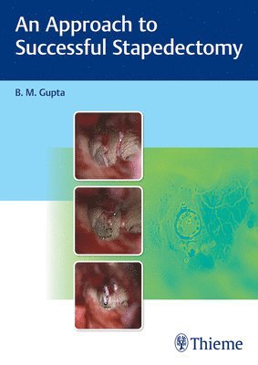 B Gupta, B. Gupta - Approach to Successful Stapedectomy, Inbunden