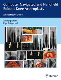 bokomslag Computer Navigated and Handheld Robotic Knee Arthroplasty