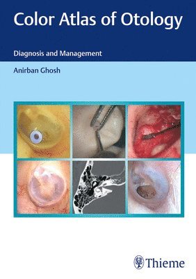 Color Atlas of Otology 1