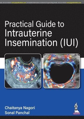 Practical Guide to Intrauterine Insemination (IUI) 1