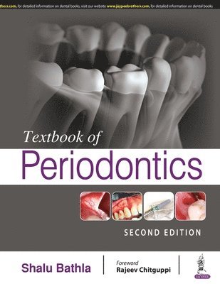 bokomslag Textbook of Periodontics