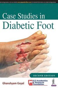 bokomslag Case Studies in Diabetic Foot