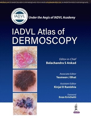 Balachandra S Ankad, Yasmeen J Bhat, Kinjal D Rambhia - Atlas of Dermoscopy, Häftad