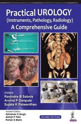 Ravindra B Sabnis, Arvind P Ganpule, Sujata K Patwardhan - Practical Urology (Instruments, Pathology, Radiology), Häftad