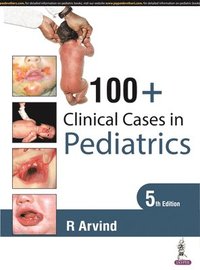 bokomslag 100+ Clinical Cases in Pediatrics