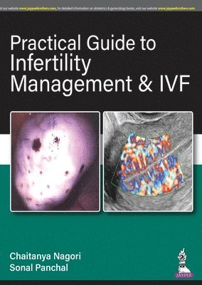 Chaitanya Nagori, Sonal Panchal - Practical Guide to Infertility Management & IVF, Häftad