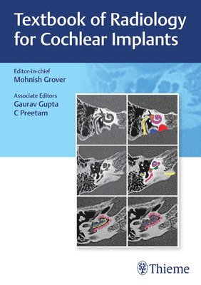 Mohnish Grover - Textbook of Radiology for Cochlear Implants, Inbunden