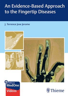 An Evidence-Based Approach to the Fingertip Diseases 1