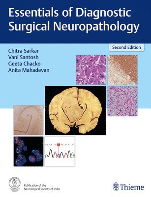 Essentials of Diagnostic Surgical Neuropathology 1