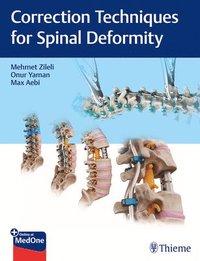 bokomslag Correction Techniques for Spinal Deformity