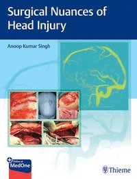 bokomslag Surgical Nuances of Head Injury