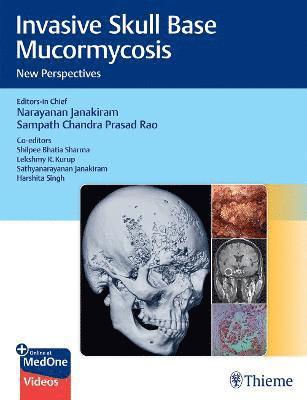 bokomslag Invasive Skull Base Mucormycosis